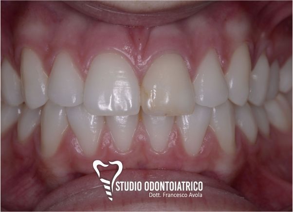 Prima del trattamento odontoiatrico