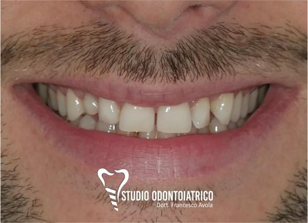 Prima del trattamento odontoiatrico